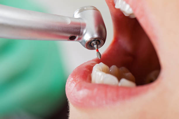 Best Emergency Orthodontic Repairs in Rancho San Diego, CA